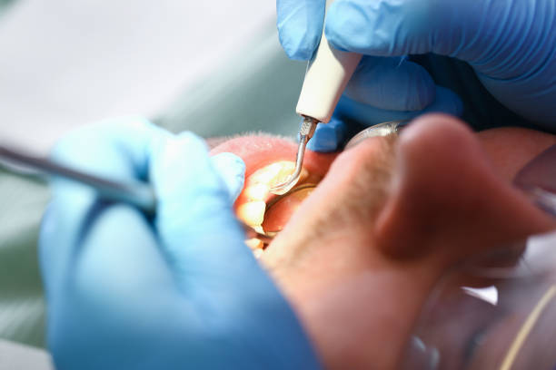 Best Emergency Care for Gum Disease in Hill N Dale, FL