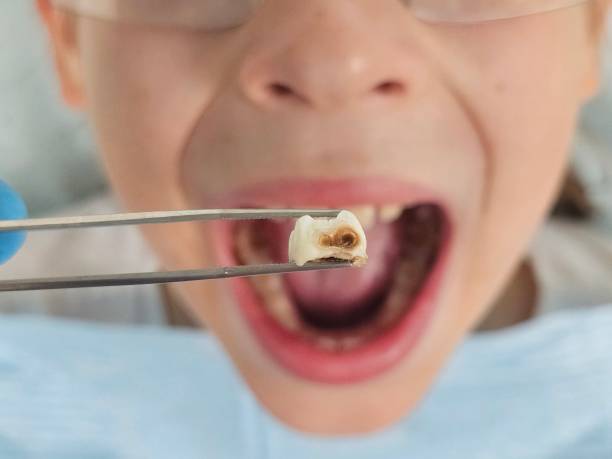 Best Emergency Dental Care for Sports Injuries in Hill N Dale, FL